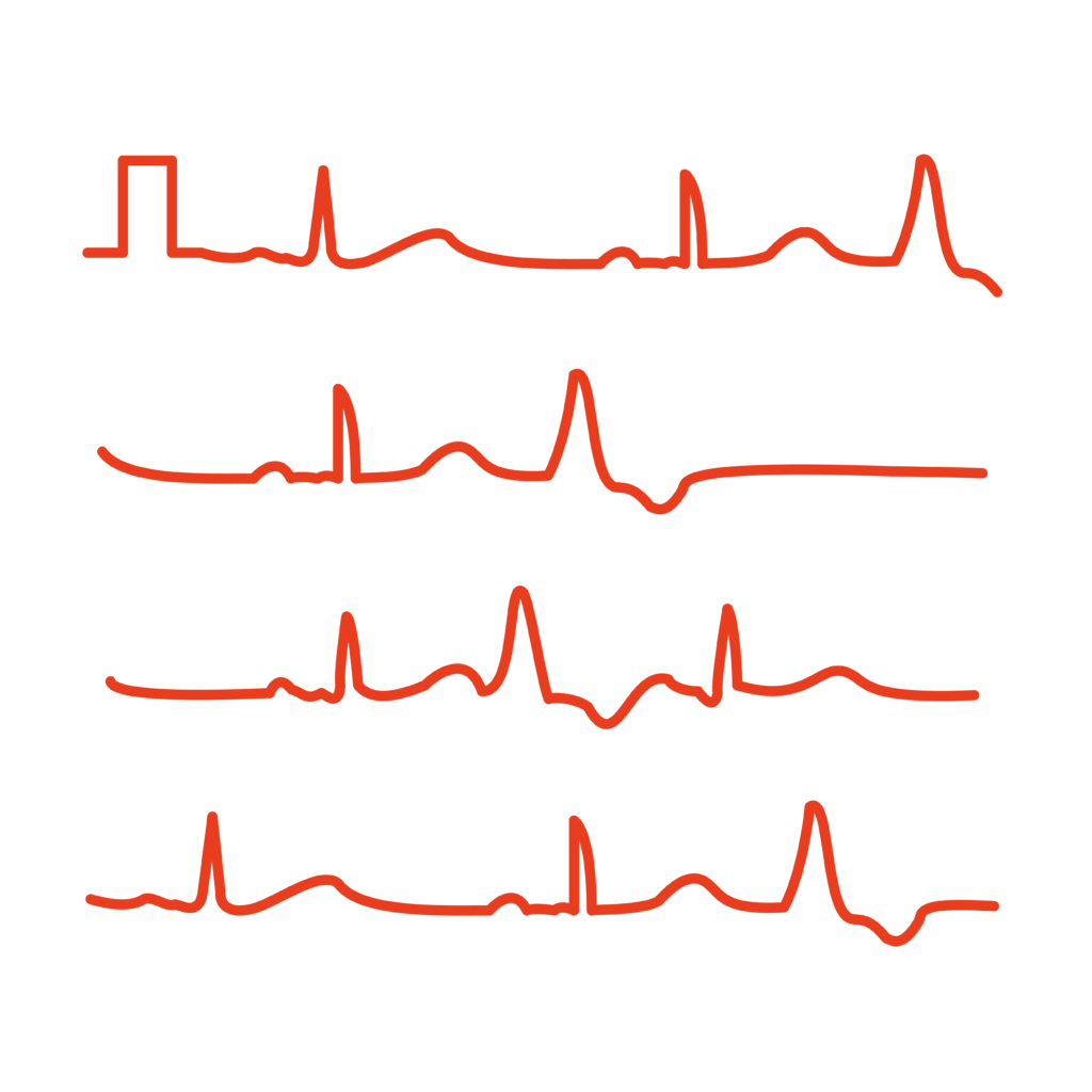Hjertets slag visualiseret som røde streger
